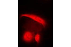 Immunofluorescent analysis of c-SRC staining in HuvEc cells. (Src Antikörper  (C-Term))
