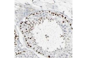 Immunohistochemical staining of human testis with SAGE1 polyclonal antibody  shows strong nuclear positivity in cells in seminiferus ducts. (SAGE1 Antikörper)