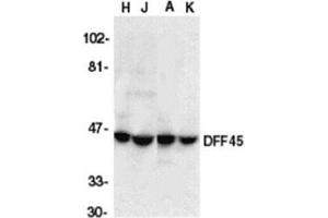 Western blot analysis of DFF45 in HeLa (H), Jurkat (J), A431 (A), and K562 (K) whole cell lysate with AP30289PU-N DFF45 antibody at 1/1000 dilution. (DFFA Antikörper  (C-Term))
