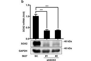 SOX2 mediates growth of bladder cancer cells. (SOX2 Antikörper)