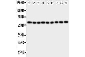 Western Blotting (WB) image for anti-Interleukin 5 Receptor, alpha (IL5RA) (AA 53-68), (N-Term) antibody (ABIN3043143) (IL5RA Antikörper  (N-Term))