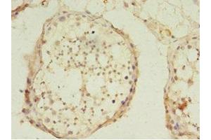 Immunohistochemistry of paraffin-embedded human testis tissue using ABIN7174332 at dilution of 1:100 (USP45 Antikörper  (C-Term))