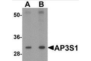 Western blot analysis of AP3S1 in mouse kidney tissue lysate with AP3S1 antibody at (A) 1 and (B) 2 μg/ml. (AP3S1 Antikörper  (Center))