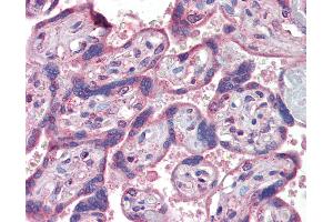 Anti-IFNAR2 antibody IHC of human placenta. (IFNAR2 Antikörper  (AA 28-40))