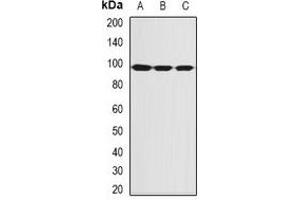 Western blot analysis of SBP-2 expression in MCF7 (A), Hela (B), mouse thymus (C) whole cell lysates. (SECISBP2 Antikörper)