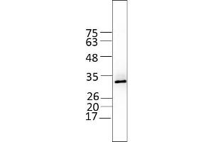 GPD1 (AA 1-349), fraction 15 - 17 (GPD1 Protein (AA 1-349) (Strep Tag))