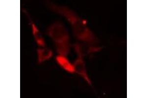 ABIN6275264 staining Hela cells by IF/ICC.