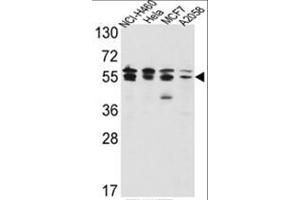 Western blot analysis of IMPDH2 Antibody (Center) in NCI-H460,Hela,MCF7,A2058 cell line lysates(35ug/lane). (IMPDH2 Antikörper  (Middle Region))