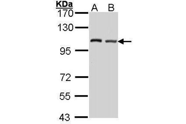 EIF4G2 Antikörper  (C-Term)