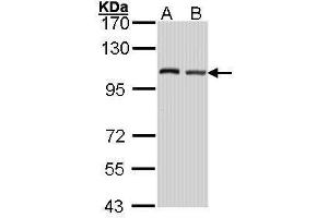 WB Image Sample (30 ug of whole cell lysate) A: Hela B: Hep G2 , 7. (EIF4G2 Antikörper  (C-Term))
