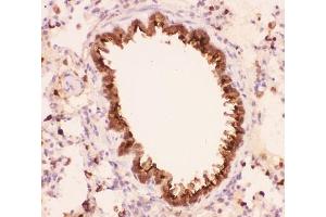 IHC-P: Annexin A1 antibody testing of rat lung tissue