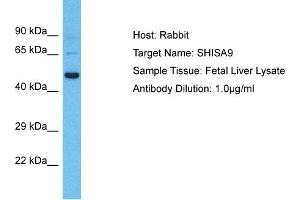 Host: Rabbit Target Name: SHISA9 Sample Type: Fetal Liver lysates Antibody Dilution: 1. (Shisa9 Antikörper  (Middle Region))