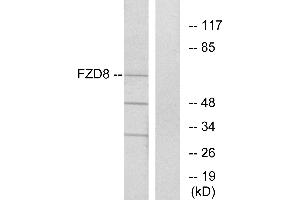Western blot analysis of extracts from Jurkat cells, using FZD8 antibody. (FZD8 Antikörper  (Internal Region))