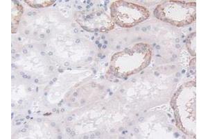 Immunohistochemistry (IHC) image for anti-Lymphocyte Cytosolic Protein 1 (LCP1) (AA 5-233) antibody (ABIN7435001)
