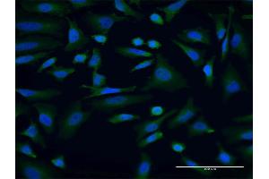 Immunofluorescence of monoclonal antibody to AKAP9 on HeLa cell. (AKAP9 Antikörper  (AA 3812-3911))