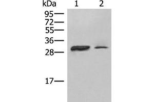 Western blot analysis of Raji cell Human spleen tissue lysates using HLA-DPA1 Polyclonal Antibody at dilution of 1:400 (HLA-DPA1 Antikörper)
