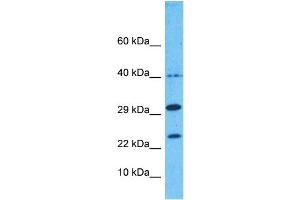 Western Blotting (WB) image for anti-Nudix (Nucleoside Diphosphate Linked Moiety X)-Type Motif 1 (NUDT1) (Middle Region) antibody (ABIN5514381)
