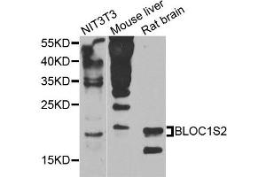 Western blot analysis of extracts of various cells, using BLOC1S2 antibody. (BLOC1S2 Antikörper)