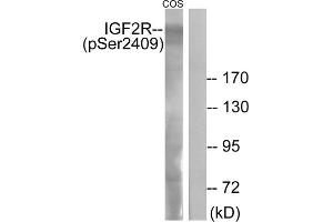 Western blot analysis of extracts from COS-7 cells, treated with UV (15mins), using IGF2R (Phospho-Ser2409) antibody.