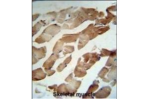 Immunohistochemistry (Paraffin-embedded Sections) (IHC (p)) image for anti-Gelsolin (GSN) (AA 230-259), (N-Term) antibody (ABIN6242369)