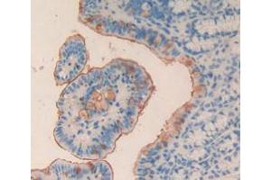 Figure. (MPL Antikörper  (AA 66-260))