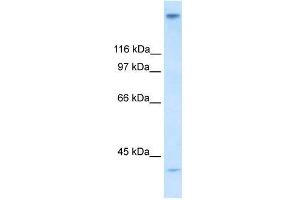 Human Stomach; WB Suggested Anti-ZNF318 Antibody Titration: 0. (ZNF318 Antikörper  (N-Term))