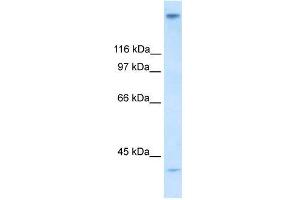 Human Stomach; WB Suggested Anti-ZNF318 Antibody Titration: 0. (ZNF318 Antikörper  (N-Term))