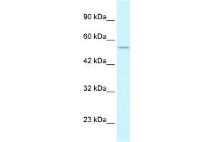 WB Suggested Anti-EGLN1 Antibody Titration:  1. (EGLN1 Antikörper  (C-Term))