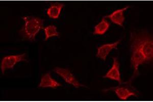 ABIN6272369 staining NIH-3T3 by IF/ICC. (OR13C8 Antikörper)