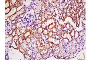 Immunohistochemistry (Paraffin-embedded Sections) (IHC (p)) image for anti-Tumor Necrosis Factor Receptor Superfamily, Member 13B (TNFRSF13B) (AA 21-120) antibody (ABIN680488)
