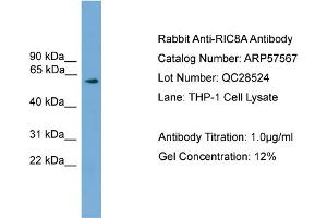 WB Suggested Anti-RIC8A  Antibody Titration: 0. (RIC8A Antikörper  (N-Term))