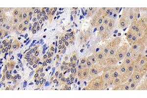 Immunohistochemistry (IHC) image for anti-Caspase 8 (CASP8) (AA 217-384) antibody (ABIN7432745)