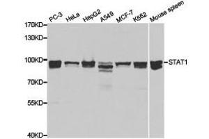 Western Blotting (WB) image for anti-Signal Transducer and Activator of Transcription 1, 91kDa (STAT1) antibody (ABIN1874962) (STAT1 Antikörper)