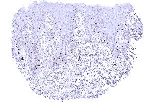 Scattered SOX10 positive melanocytes in the epidermis of the skin