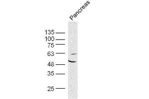 Mouse pancreas lysates probed with AKT1/3 Polyclonal Antibody, unconjugated  at 1:300 overnight at 4°C followed by a conjugated secondary antibody at 1:10000 for 90 minutes at 37°C. (AKT1/3 (AA 401-479) Antikörper)
