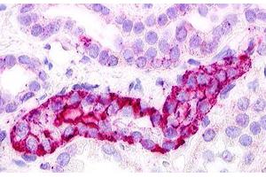 Image no. 1 for anti-G Protein-Coupled Receptor, Family C, Group 5, Member D (GPRC5D) (Extracellular Domain) antibody (ABIN1048919) (GPRC5D Antikörper  (Extracellular Domain))