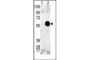 Western blot analysis of AKT2 (arrow) using AKT2 Antibody (AKT2 Antikörper  (C-Term))