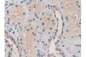 Immunohistochemistry (IHC) image for anti-Matrix Metallopeptidase 19 (MMP19) (AA 98-508) antibody (ABIN7434200)
