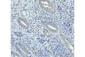 IHC analysis of RPL23 using anti-RPL23 antibody (ABIN7599808). (RPL23 Antikörper  (AA 12-136))