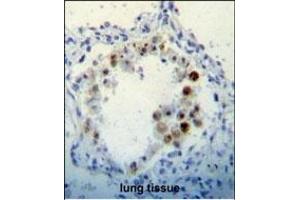 Immunohistochemistry (Paraffin-embedded Sections) (IHC (p)) image for anti-Cyclin-Dependent Kinase Inhibitor 2B (p15, Inhibits CDK4) (CDKN2B) (AA 102-130), (C-Term) antibody (ABIN656561)