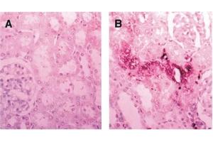 Immunohistochemistry image of CRA-modified protein staining in paraffn sections of rat kidney exposed to ferric nitrilotriacetate. (Crotonaldehyde (CRA) Antikörper)