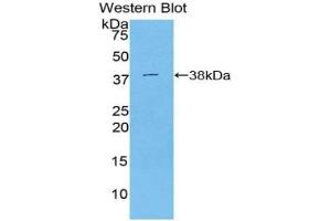 Western blot analysis of the recombinant protein. (STAP1 Antikörper  (AA 1-297))