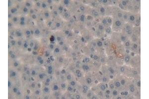 Immunohistochemistry (IHC) image for anti-Plasminogen (PLG) (AA 191-433) antibody (ABIN7429070)
