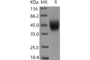 Western Blotting (WB) image for Interleukin 2 Receptor, gamma (IL2RG) protein (His tag) (ABIN7321196) (IL2RG Protein (His tag))