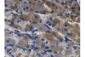 DAB staining on IHC-P; Samples: Human Stomach Tissue (RNASE3 Antikörper  (AA 30-154))