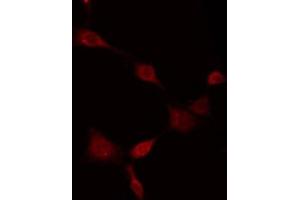 ABIN6275281 staining HT29 by IF/ICC. (MT-ND5 Antikörper  (Internal Region))