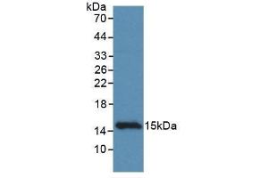 Detection of Recombinant CCDC60, Rat using Monoclonal Antibody to Coiled Coil Domain Containing Protein 60 (CCDC60) (CCDC60 Antikörper  (AA 127-236))