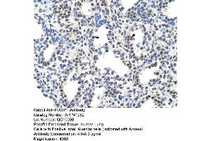 Rabbit Anti-FUSIP1 Antibody  Paraffin Embedded Tissue: Human Lung Cellular Data: Alveolar cells Antibody Concentration: 4. (SRSF10 Antikörper  (C-Term))