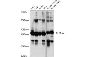 Western blot analysis of extracts of various cell lines, using MTHFD2 antibody (ABIN6132367, ABIN6144144, ABIN6144145 and ABIN6214625) at 1:1000 dilution.