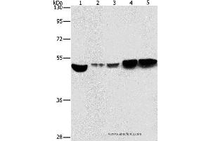 Western blot analysis of Hela and A431 cell, mouse brain and liver tissue, mouse pancreas tissue, using ENO1 Polyclonal Antibody at dilution of 1:500 (ENO1 Antikörper)